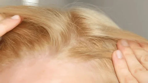 How to Reduce Blonde Hair Thinning: Expert-Backed Tips for Stronger, Fuller Hair