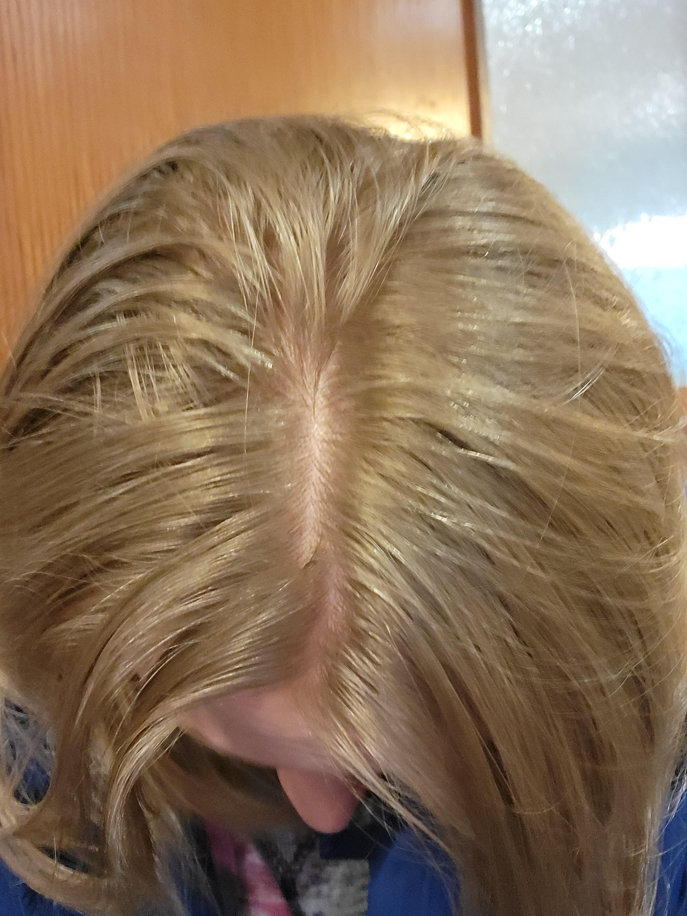 do highlights thin hair?