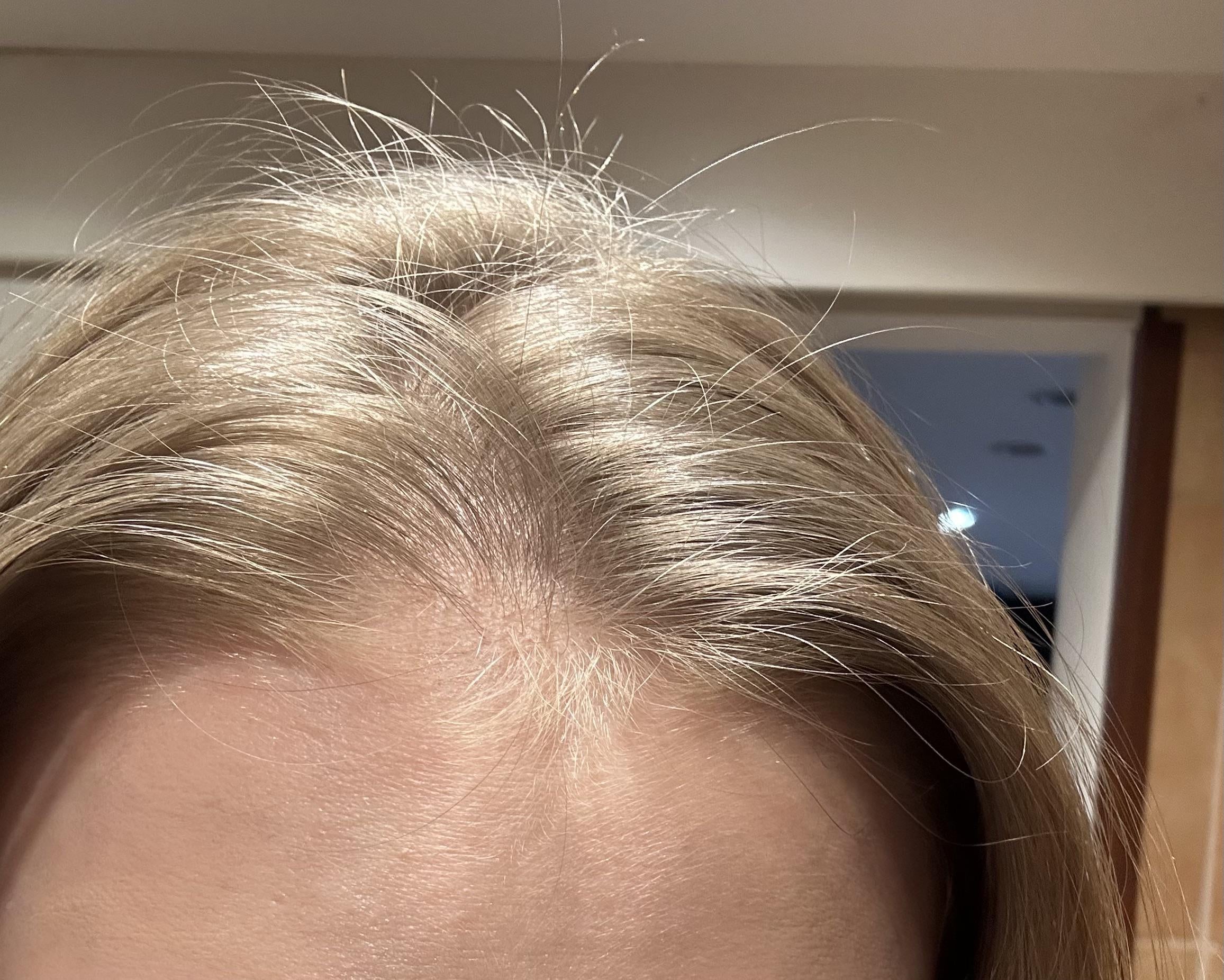 Does Bleach Thin Your Hair?