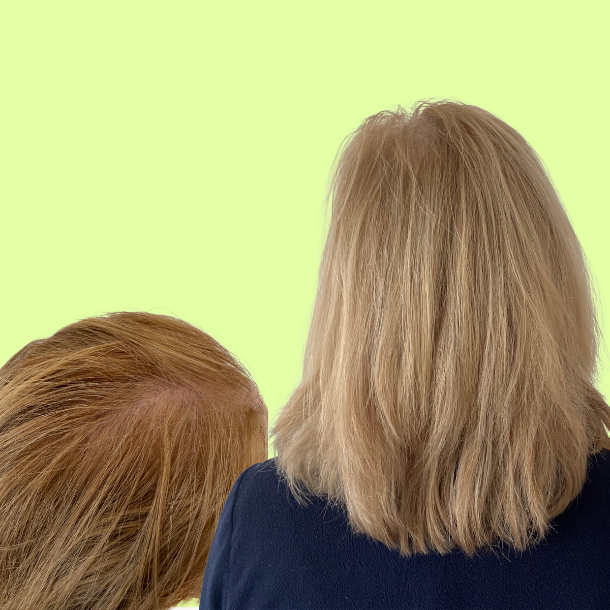hair-thinning-improvements-hair-oil-blonde